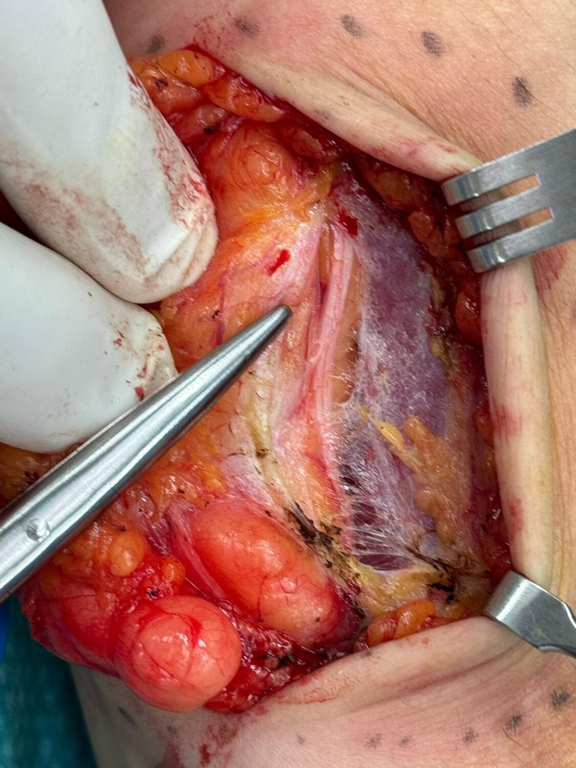 Clinical Image