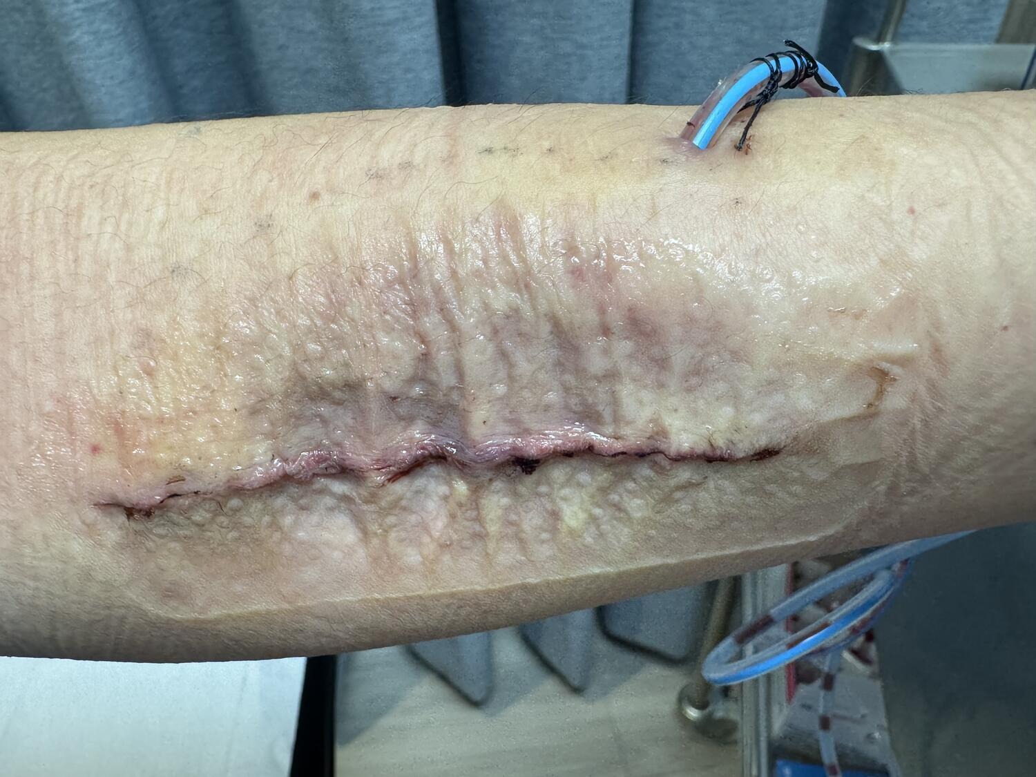 Recovery Image