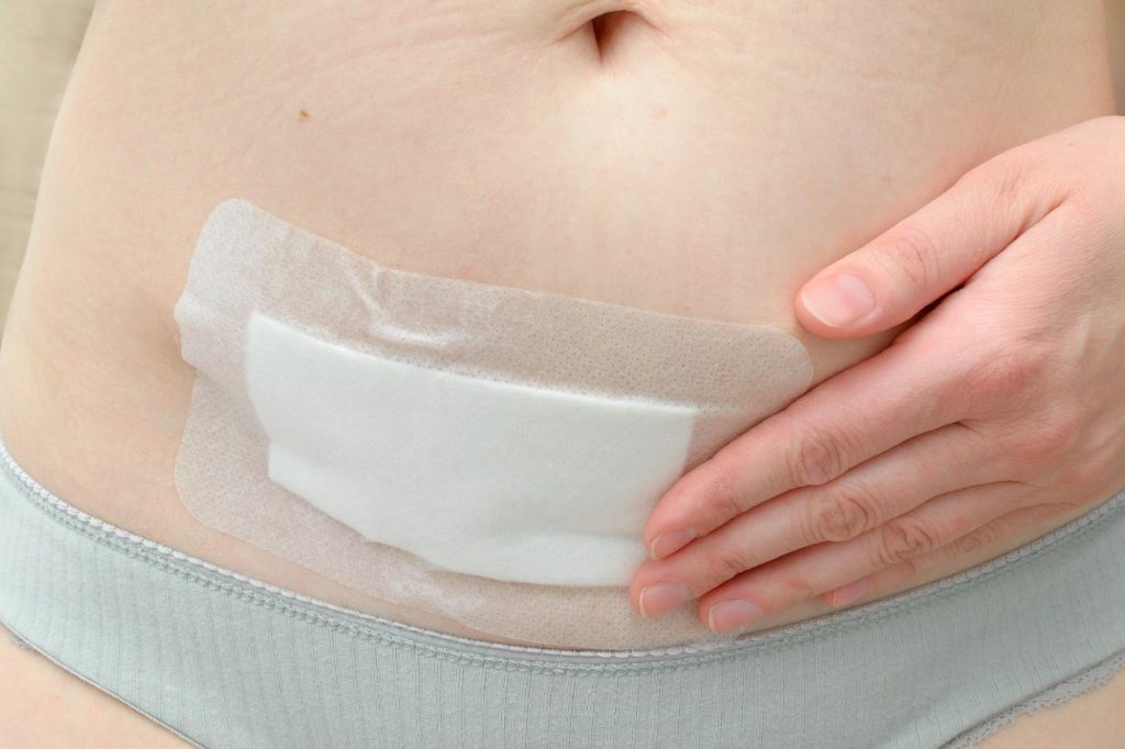 causes abdominal adhesions.