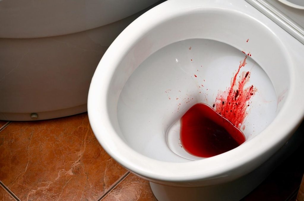 symptoms of internal haemorrhoids rectal bleeding Singapore.